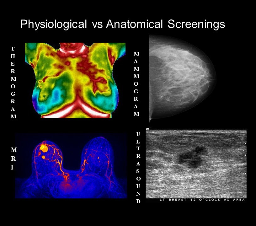 Premium Vector  Thermography of female chest thermographic image of breast